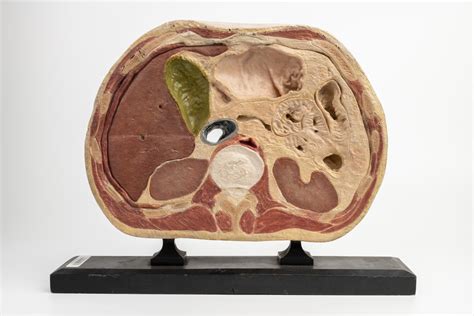 Steger His Model Of Transverse Section Abdominal Dissection Faculty