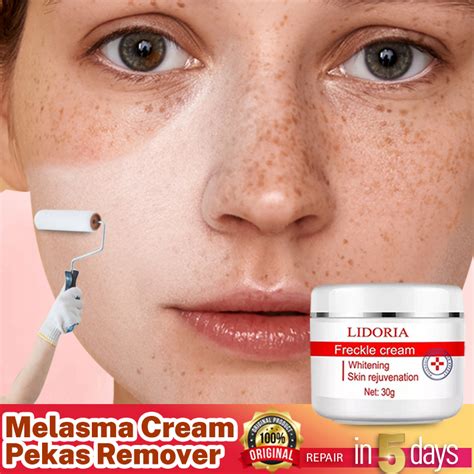 Pekas Remover Effective Melasma Cream Anti Freckle Collagen Original