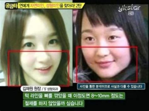 강민경 데뷔초와 비교해 확연히 예뻐진 외모 ‘성형 논란 휩싸일만한 아름다움 김유표 기자 톱스타뉴스