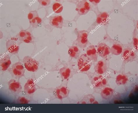 Neisseria Gonorrhoeae Gram Stain