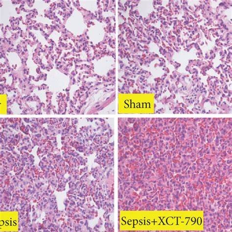 Inhibition Of Err Aggravated Clp Induced Lung Injury And Lung Vascular