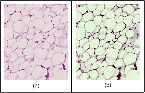 Adipose Tissue Histology