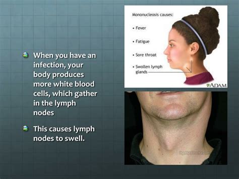 PPT - Lymphatic System: Pathogen Defense Mechanisms PowerPoint