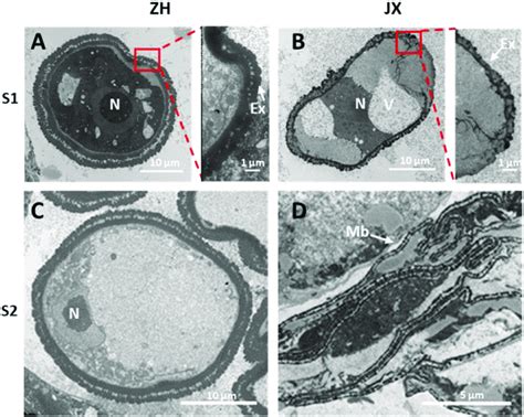 Transmission Electron Microscopy Tem Scans Of Microspore Features