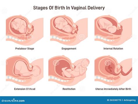 Stages Of Baby Birth In Vaginal Delivery Fetus Movement During The