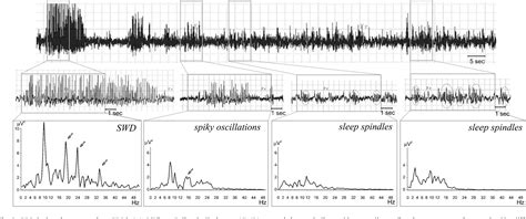 Figure From Sleep Spindles And Spikewave Discharges In Eeg Their