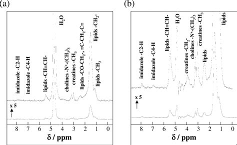 Typical 1 H NMR Spectrum Of Human Lower Leg Muscles Gastrocnemius At