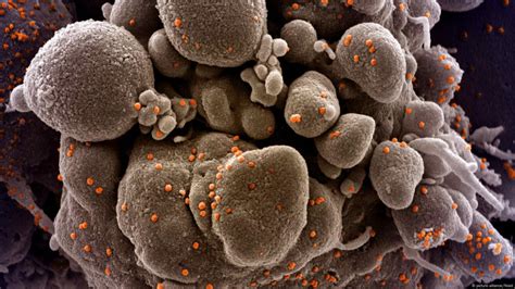 COVID mutation no reason to panic: virologist – DW – 12/21/2020 