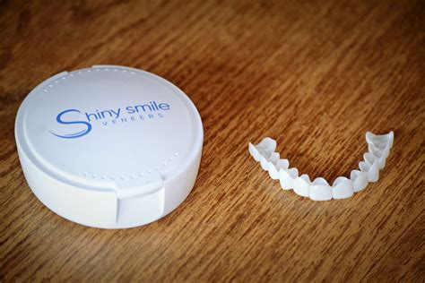 Shiny Smile Snap-On Veneers: Do They Deliver on The Hype?