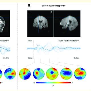 Tms Eeg Responses To M Stimulation In Representative Subjects A