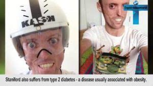 The 10 Most Bizarre People In The World You Won T Believe Actually