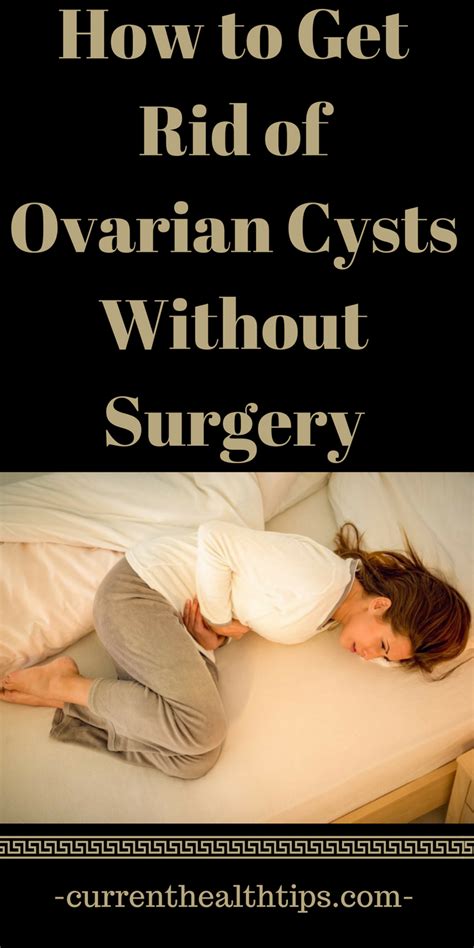 How To Get Rid Of Ovarian Cysts Without Surgery CurrentHealthTips