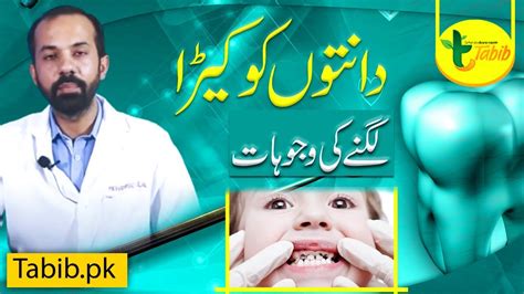 Dental Common Problems Scaling Polishing Teeth Cavity In Urdu By Dr Bilal Tabib Pk Youtube