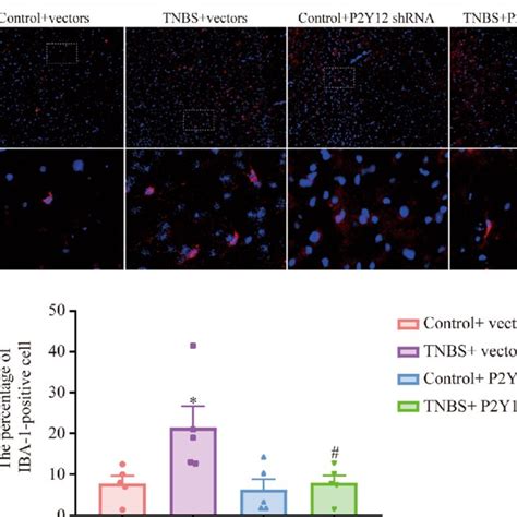 P2Y12 ShRNA Treatment Changed The Morphology Of Microglia In The MPFC