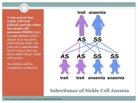 Sickle Cell Anaemia