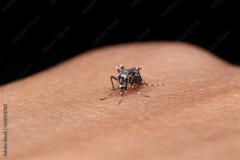 Dengue mosquito biting on hand Stock Photo | Adobe Stock