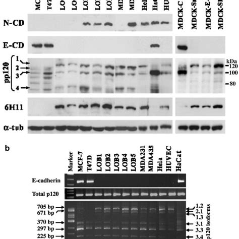 Examination of E-cadherin, beta-catenin, alpha-catenin and p120-catenin... | Download Scientific ...