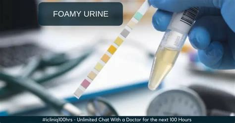 Is It Normal To Have Foamy Urine