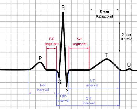 Electrocardiogram Diagram