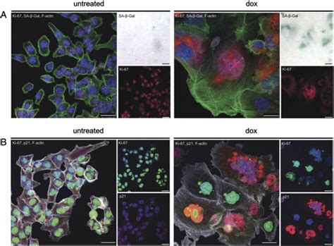 Nuclear Protein Staining Ki And P And Sa Gal Activity In