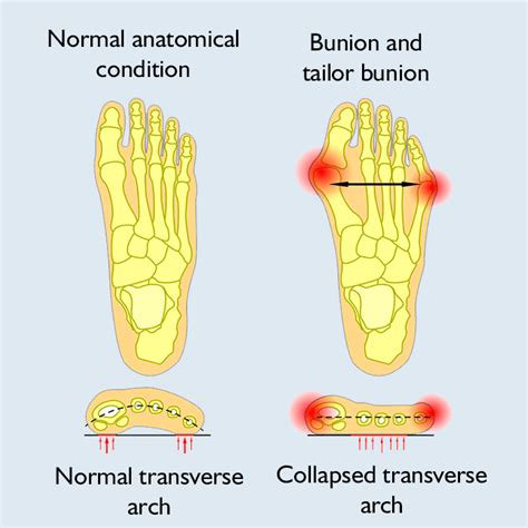 B Union Removal
