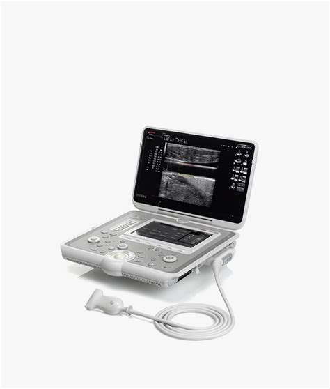 Mylabx The New Handheld Ultrasound System Esaote