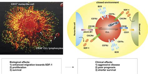 CD38 As A Pathogenetic Agent In CLL Left CD38 CLL Lymphocytes White