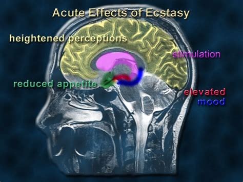 Patients To Recieve MDMA Assisted Psychotherapy On Compassionate