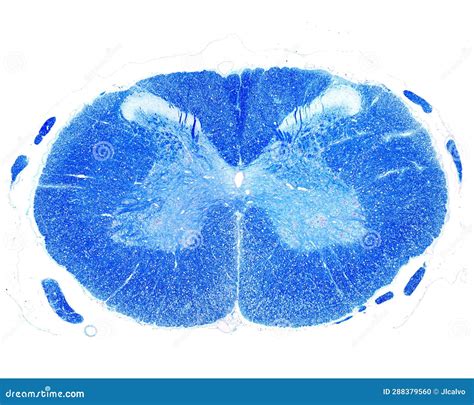 Human Spinal Cord Luxol Fast Blue Stain Stock Photo Image Of Matter