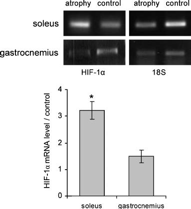 Comparison Of Hif Mrna Expression In Soleus And Gastrocnemius