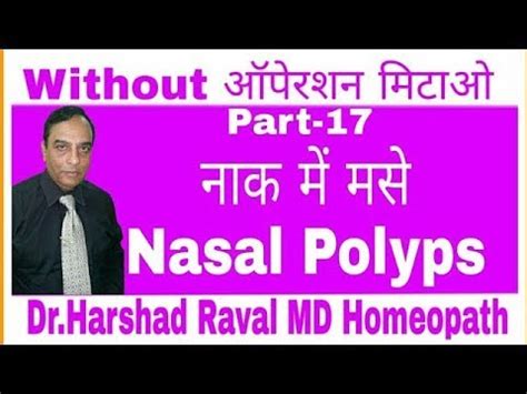 Nasal Polyps Homeopathy Treatment And Homeopathic Medicine Youtube