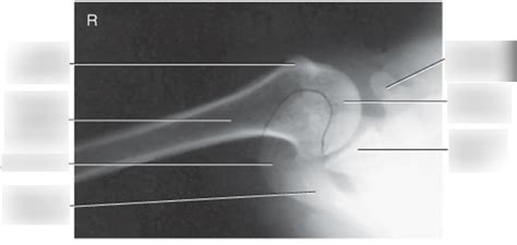 Diagram Inferosuperior Axial Lawrence Method Shoulderxray 2018