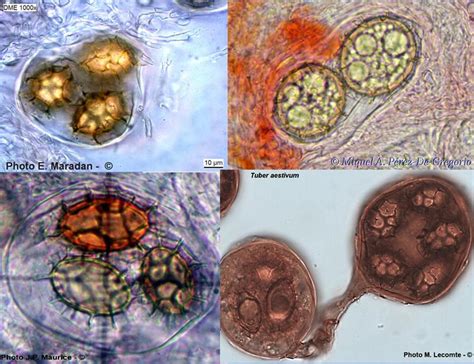 Myco Microscopie Ascospores De Tuber Aestivum M P Rez De Gregorio