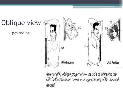 Chest x ray positioning