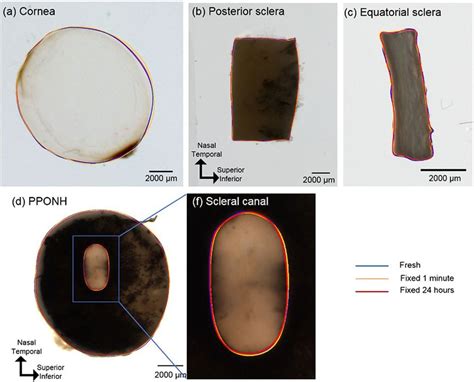 Images From Fresh Unfixed Ocular Tissues Overlaid With Example Manual