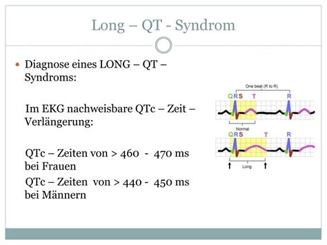 Ppt Kardiale Nebenwirkungen Der Pharmakotherapie Bei Adhs Powerpoint