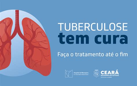 Tuberculose Tem Cura Hospital De Messejana Refor A A Import Ncia Do