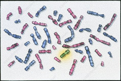 Artwork based on LM of Down's syndrome chromosomes - Stock Image - M352/0027 - Science Photo Library