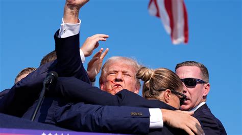 Impactante Así Le Quedó El Rostro A Donald Trump Tras El Atentado Que