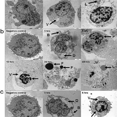 Transmission Electron Microscopic Appearance Of CEM SS Cells Treated