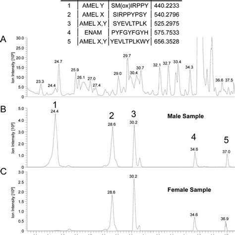 A Representative Base Peak Chromatogram 300 1600 Mz From A Male Download Scientific