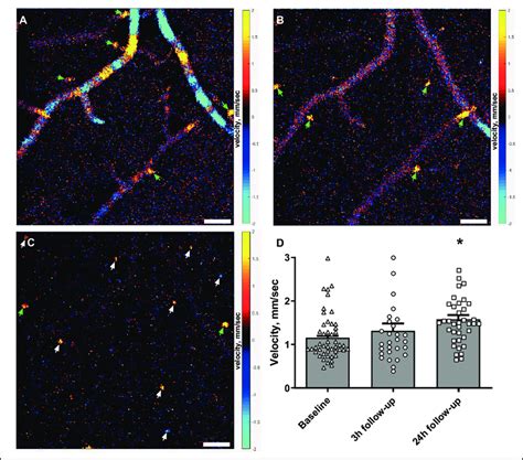 Capillary flow velocity was increased at the 24-hour follow-up ...