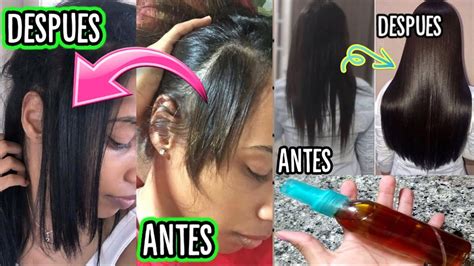 🤯detÉn La CaÍda Del Cabello Y Consigue Una Cabellera Super Larga😱