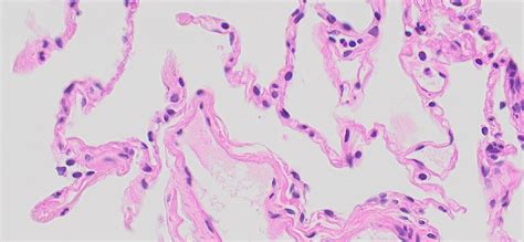 Human Lung Tissue Normal Ffpe Sections