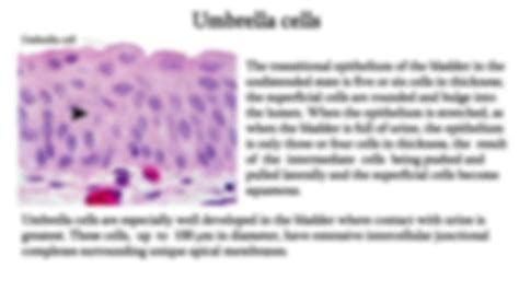 Solution Urogenital System Histology And Embryology Part Studypool