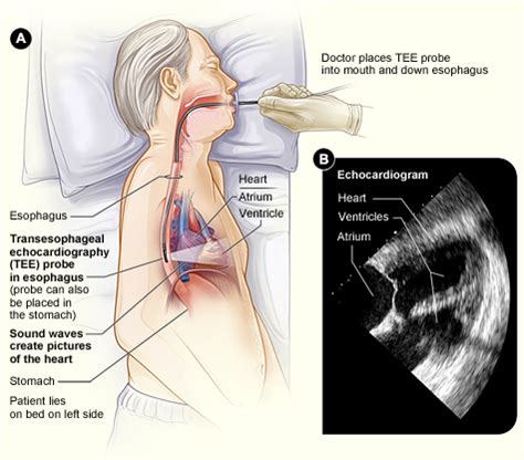 Choque Cardiog Nico Diagn Stico Nhlbi Nih