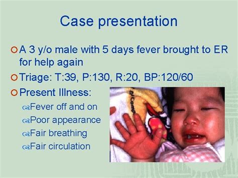 Kawasaki Disease Mucocutaneous Lymph Node Syndrome Pediatric Group