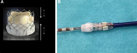 How To Adapt The Implantation Technique For The New Sapien 3