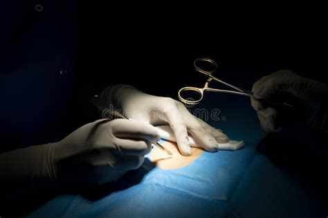 Doctor and Hospital Staff in the Operating Room Stock Image - Image of ...