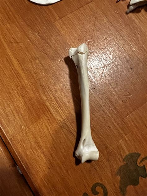 Anterior Humerus Diagram Quizlet